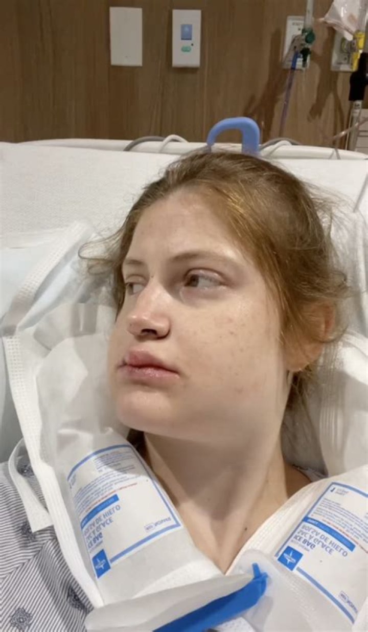 Brielle Biermann Has Recovered from Her Double Jaw Surgery