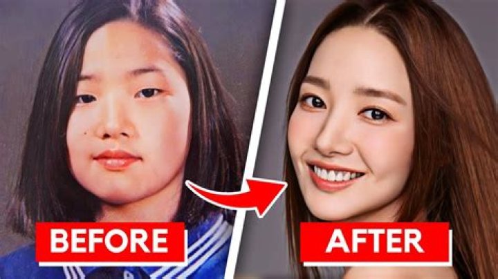 Kim Keon Hee Before Surgery: Plastic Surgery Transformation