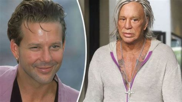 Mickey Rourke Before And After Photos And Plastic Surgery 2023