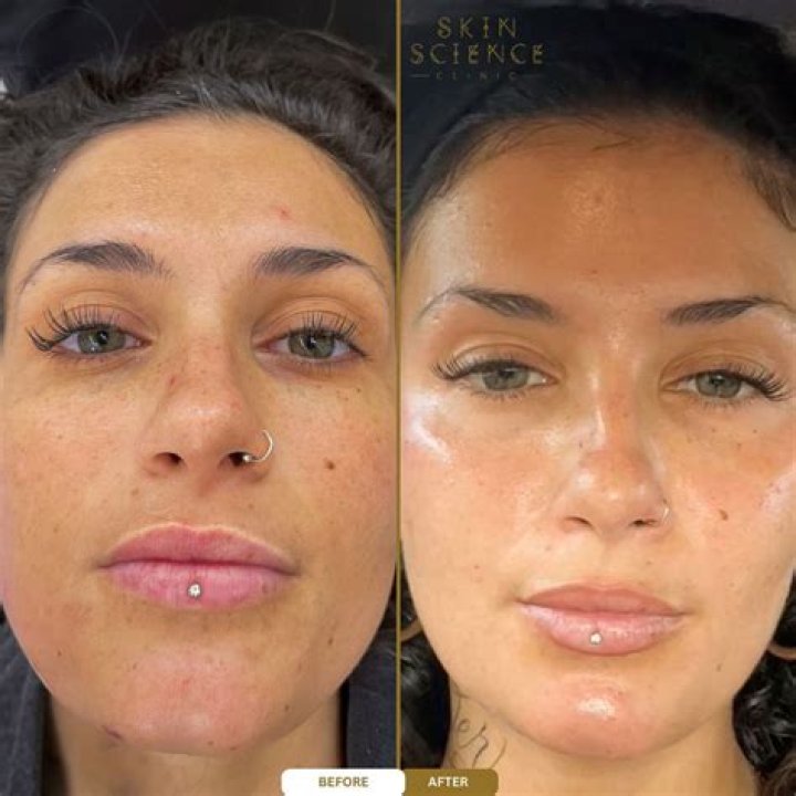 Nazanin Kavari Before And After Photos: BBL And Nose Job