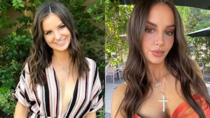 Vanessa The Ultimatum Queer Nose Job Before And After Photos